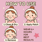 Star-Shaped Hydrogel Acne Patches — 240 Pink & Yellow Pimple Stickers, All Skin Types